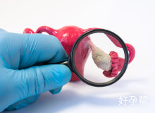 备孕前三个月饮食全攻略：科学调理轻松提高受孕成功率