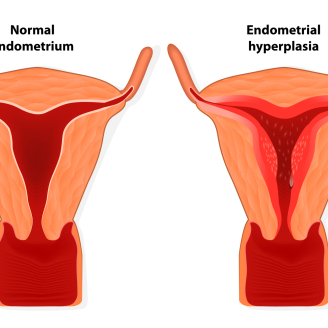 东莞AMH检查卵巢早衰费用详解：检测流程、医院选择及最新价格指南