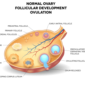 济南专家分享多囊卵巢调理最有效方法,科学助孕恢复健康