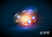 巧克力囊肿患者必读：日常注意事项与饮食调理指南