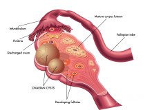 卵巢多囊怎么调理最有效？详解2025科学调理方案