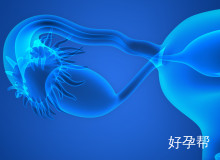 多囊卵巢综合症患者人工授精指南：条件与成功率解析