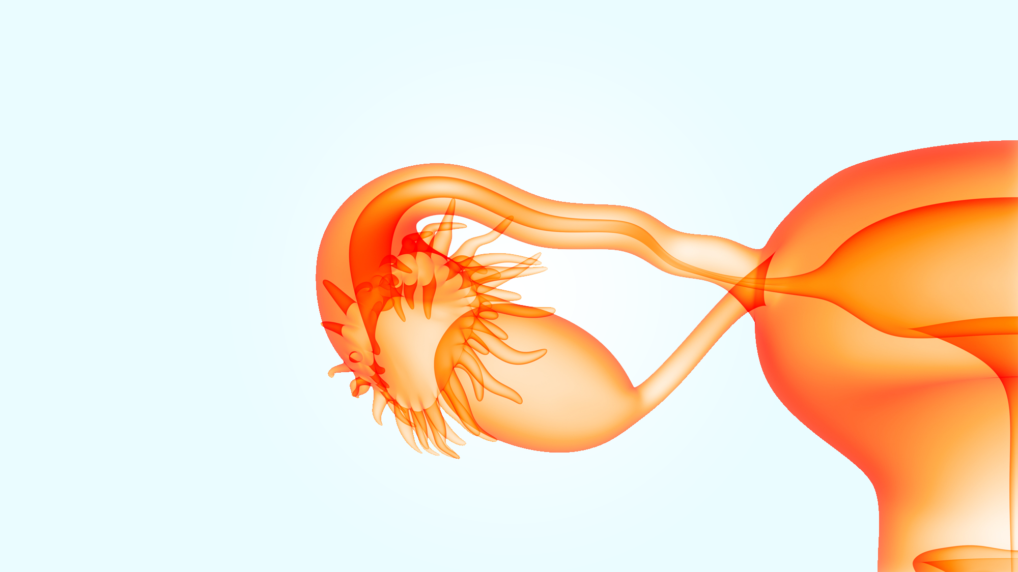腹腔镜手术示意图