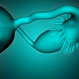 轻度多囊卵巢综合征有哪些典型症状表现？