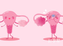 惊人真相：女性为什么会长巧克力囊肿？深入剖析背后五大诱因