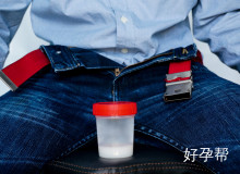 多囊卵巢综合征能治愈吗？科学解析治疗与调理方案