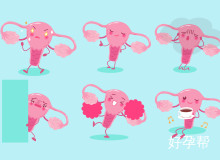 多囊卵巢综合征能治愈吗？专家解析治疗方法与生育可能