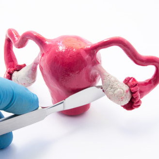 宫腔镜手术前要换上一次性内裤吗？及术前术后全攻略