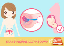多囊卵巢中医治疗全解析：辨证论治与特色疗法详解
