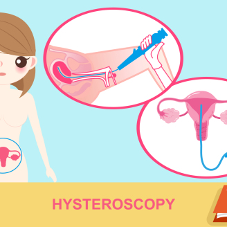 双卵巢多囊样改变是什么意思?症状、病因及治疗全解析(2025最新版)