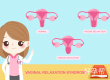 治疗多囊卵巢综合症的三大有效方法及专家推荐方案