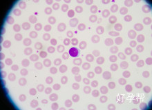 45-55岁绝经正常吗？女性绝经年龄科学解读