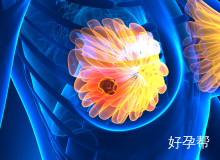 河北医科大学二院东院妇科石主任怎么样？专业实力与患者口碑深度解析