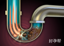 曼月乐环对子宫内膜增生的作用与副作用解析