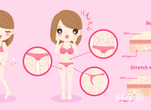 静脉曲张必做检查项目：5种诊断方法全解析