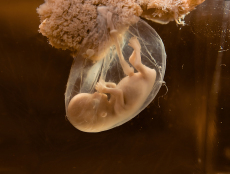 广东省妇幼保健院三代试管费用2026年最新汇总，8 - 12万元明细全公开