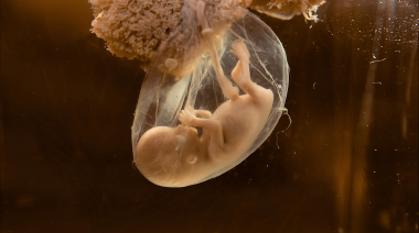 输卵管检查哪种方法最准确？腹腔镜和造影术对比