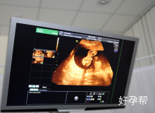 2025年试管婴儿术前准备费用多少钱？超全费用明细及省钱攻略全解析