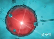 多囊卵巢综合症试管成功经验分享：从促排到移植的全程指南