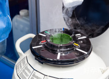 试管取卵前必知：E2正常值范围解析及影响因素