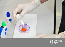 卵巢囊肿能做试管婴儿吗？关键因素与医生建议解析